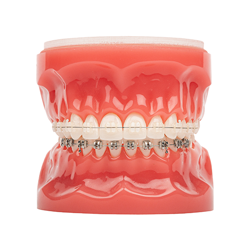 Orthodontic Treatment